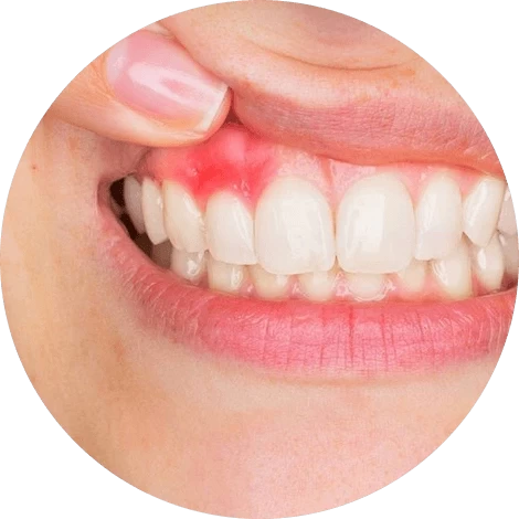 Баннер Лечение десен